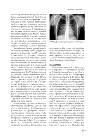 cuando el paciente está en reposo o desarro-
llando una actividad normal. Generalmente
el paciente se queja de dolor pleurítico y/o dis-
nea aguda de forma repentina. El dolor puede
ser leve o severo en el comienzo y continúa
como dolor pesado que se acentúa con los
movimientos respiratorios. Si el N es pequeño,
el dolor puede ser el único síntoma y desapa-
rece unas horas más tarde. Muchos de estos
pacientes no acuden a la consulta médica o
acuden sólo tardíamente. En caso de N masi-
vo o a tensión, la presentación clínica es más
acusada. Otros síntomas, como tos irritativa,
ortopnea y hemoptisis son menos frecuentes.
La exploración física de los pacientes con
un N mínimo puede ser normal. El signo más
común es la taquicardia. En el N moderado
o en el masivo, se pueden detectar la dismi-
nución de movimiento del hemitórax afecta-
do, el aumento de resonancia en percusión y
la disminución tanto del murmullo vesicular
como de la transmisión de la voz en auscul-
tación. En caso de N a tensión se puede obser-
var la presencia de cianosis, hipotensión y
taquicardia mayor de 135 latidos por minuto.
La gasometría arterial suele ser normal en el
N pequeño pero en los de más del 25% se
observa hipoxemia y aumento del gradiente
de oxígeno alvéolo-arterial(24). En el N hiper-
tensivo, son frecuentes una hipoxemia seve-
ra y alcalosis respiratoria. Las alteraciones
en el electrocardiograma son raras, aunque,
en el N masivo izquierdo, la presencia de aire
puede ocasionar una disminución del com-
plejo QRS y de onda R y una inversión de onda
T que hacen confundirlo con un infarto de mio-
cardio de la pared anterior.
Los síntomas y signos en pacientes con
enfermedades pulmonares asociadas son
mucho más llamativos. Un N pequeño en
pacientes con EPOC grave puede causar dis-
nea, hipercapnia e hipoxemia severa, e inclu-
so hipotensión y fracaso cardio-respiratorio.
La exploración física es poco reveladora debi-
do a la enfermedad de base. Ante un pacien-
te con EPOC y la aparición de dolor torácico
unilateral y aumento de disnea sin una apa-
rente causa, se debe pensar en la posibilidad
de N y buscar la confirmación radiológica. En
el N traumático, el enfisema subcutáneo y la
herida soplante (el aire entra y sale por la heri-
da con los movimientos respiratorios) son los
signos físicos más característicos.
DIAGNÓSTICO
Las manifestaciones clínicas suelen suge-
rir el diagnóstico de N al médico que está aler-
ta. El diagnóstico se confirma al identificar la
línea de la pleura visceral en la radiografía pos-
tero-anterior del tórax (Fig. 2). En caso de duda
o de N pequeño apical, la radiografía en espi-
ración forzada o en decúbito lateral puede ayu-
dar al diagnóstico. Con cierta frecuencia el N
se acompaña de un pequeño derrame pleural
seroso con eosinofilia, como consecuencia de
irritación pleural por el aire. Un derrame mayor
puede significar un hemoneumotórax en caso
de N traumático o NE primario y un proba-
ble pioneumotórax en caso de NE secundario.
En el N hipertensivo, se observa en la radio-
grafí un colapso total del pulmón del lado afec-
tado y el desplazamiento contralateral del
mediastino. En pacientes con NE secundario
o en traumatismos, se pueden encontrar otras
lesiones parietales, pulmonares o mediastí-
nicas asociadas, cuya identificación es impor-
tante para plantear el diagnóstico diferencial
y el tratamiento. Algunas veces en el enfise-
ma bulloso, la diferenciación entre una gran
bulla y un N puede ser muy difícil. Por regla
185
NEUMOTÓRAX Y HEMOTÓRAX
FIGURA 2. Línea de pleura visceral en Rx Tórax.
Pleura 224p 9/7/13 10:23 Página 185
 