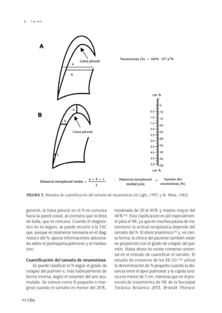 general, la línea pleural en el N es convexa
hacia la pared costal, al contrario que la línea
de bulla, que es cóncava. Cuando el diagnós-
tico no es seguro, se puede recurrir a la TAC
que, aunque es raramente necesaria en el diag-
nóstico del N, aporta informaciones adiciona-
les sobre el parénquima pulmonar y el medias-
tino.
Cuantificación del tamaño de neumotórax
Se puede clasificar el N según el grado de
colapso del pulmón o, más habitualmente de
forma inversa, según el volumen del aire acu-
mulado. Se conoce como N pequeño o mar-
ginal cuando el tamaño es menor del 20%,
moderado de 20 al 40% y masivo mayor del
40%(25). Esta clasificación es útil especialmen-
te para el NE, ya que en muchas pautas de tra-
tamiento la actitud terapéutica depende del
tamaño del N. El shuntanatómico(24) y, en cier-
ta forma, la clínica del paciente también están
en proporción con el grado de colapso del pul-
món. Hasta ahora no existe consenso univer-
sal en el método de cuantificar el tamaño. El
estudio de consenso de los EE.UU.(26) utiliza
la denominación de N pequeño cuando la dis-
tancia entre el ápex pulmonar y la cúpula torá-
cica es menor de 3 cm, mientras que en el pro-
tocolo de tratamiento de NE de la Sociedad
Torácica Británica (BTS, Bristish Thoracic
186
 Y.W. PUN
FIGURA 3. Métodos de cuantificación del tamaño de neumotórax [A) Light, 1993, y B) Rhea, 1982].
A
B
Pleura 224p 9/7/13 10:23 Página 186
 