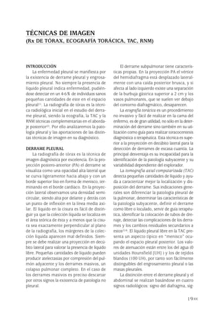 INTRODUCCIÓN
La enfermedad pleural se manifiesta por
la existencia de derrame pleural y engrosa-
miento pleural. No siempre la presencia de
líquido pleural indica enfermedad, pudién-
dose detectar en un 4-6% de individuos sanos
pequeñas cantidades de este en el espacio
pleural(1). La radiografía de tórax es la técni-
ca radiológica inicial en el estudio del derra-
me pleural, siendo la ecografía, la TAC y la
RNM técnicas complementarias en el aborda-
je posterior(2). Por ello analizaremos la pato-
logía pleural y las aportaciones de las distin-
tas técnicas de imagen en su diagnóstico.
DERRAME PLEURAL
La radiografía de tórax es la técnica de
imagen diagnóstica por excelencia. En la pro-
yección postero-anterior (PA) el derrame se
visualiza como una opacidad alta lateral que
se curva ligeramente hacia abajo y con un
borde superior liso en forma de menisco, ter-
minando en el borde cardiaco. En la proyec-
ción lateral observamos una densidad semi-
circular, siendo alta por delante y detrás con
un punto de inflexión en la línea media axi-
lar. El líquido en la cisura es fácil de distin-
guir ya que la colección líquida se localiza en
el área teórica de ésta y a menos que la cisu-
ra sea exactamente perpendicular al plano
de la radiografía, los márgenes de la colec-
ción líquida aparecen mal definidos. Siem-
pre se debe realizar una proyección en decú-
bito lateral para valorar la presencia de líquido
libre. Pequeñas cantidades de líquido pueden
producir atelectasias por compresión del pul-
món adyacente y los derrames masivos, un
colapso pulmonar completo. En el caso de
los derrames masivos es preciso descartar
por otros signos la existencia de patología no
pleural.
El derrame subpulmonar tiene caracterís-
ticas propias. En la proyección PA el vértice
del hemidiafragma está desplazado lateral-
mente con una caída posterior brusca, y si
afecta al lado izquierdo existe una separación
de la burbuja gástrica superior a 2 cm y los
vasos pulmonares, que se suelen ver debajo
del contorno diafragmático, desaparecen.
La ecografía torácica es un procedimiento
no invasivo y fácil de realizar en la cama del
enfermo, es de gran utilidad, no sólo en la deter-
minación del derrame sino también en su uti-
lización como guía para realizar toracocentesis
diagnóstica o terapéutica. Esta técnica es supe-
rior a la proyección en decúbito lateral para la
detección de derrames de escasa cuantía. La
principal desventaja es su incapacidad para la
identificación de la patología subyacente y su
variabilidad dependiente del explorador.
La tomografía axial computarizada (TAC)
detecta pequeñas cantidades de líquido y ayu-
da a caracterizar mejor la localización y dis-
posición del derrame. Sus indicaciones gene-
rales son diferenciar la patología pleural de
la pulmonar, determinar las características de
la patología subyacente, definir el derrame
como libre o loculado, servir de guía terapéu-
tica, identificar la colocación de tubos de dre-
naje, detectar las complicaciones de los derra-
mes y los cambios residuales secundarios a
estos(3,4). El líquido pleural libre en la TAC pre-
senta un aspecto típico en “menisco” ocu-
pando el espacio pleural posterior. Los valo-
res de atenuación están entre los del agua (0
unidades Hounsfield [UH] ) y los de tejidos
blandos (100 UH), por tanto son fácilmente
distinguibles del engrosamiento pleural o las
masas pleurales.
La distinción entre el derrame pleural y el
abdominal se realizan basándose en cuatro
signos radiológicos: signo del diafragma, sig-
19
TÉCNICAS DE IMAGEN
(Rx DE TÓRAX, ECOGRAFÍA TORÁCICA, TAC, RNM)
Pleura 224p 9/7/13 10:22 Página 19
 