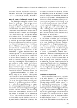 sitio de la punción, abscesos subcutáneos,
empiema, neumomediastino y embolia gase-
osa(4,14,15). La mortalidad es menor del 0,2%(16).
Tipos de aguja y técnica de la biopsia pleural
Las dos agujas más usadas en todo el mun-
do son las de Abrams y Cope, aunque existen
otras como las de Raja, Castelain, Ramel, etc.
La aguja de Abrams consta de tres partes: un
trocar externo, una cánula cortante interna y
un estilete. El trocar externo mide 4 mm de
diámetro, es hueco y tiene la punta roma, para
no lacerar el pulmón; por ello requiere de inci-
sión cutánea previa con bisturí. En su extre-
mo distal presenta una ventana y en su par-
te proximal un pivote que indica la posición
de la misma. La cánula interna tiene un extre-
mo distal cortante que, una vez introducido
dentro del trocar externo, al que se adapta
estrechamente, puede colocarse cerrada o
abierta, según ocluya o no la ventana del tro-
car externo. La aguja se introduce con sus tres
partes acopladas. La cánula interna se gira en
el sentido de las agujas del reloj hasta cerrar
la ventana del trócar externo. Se introduce la
aguja en sentido perpendicular a la pared torá-
cica y siempre siguiendo el borde superior de
una costilla; se pueden realizar movimientos
de rotación hacia uno y otro lado para ayu-
darse. Normalmente se nota cuando se ha
entrado en el espacio pleural por la pérdida de
resistencia. Entonces se retira el estilete, con
la aguja en posición cerrada, y se conecta una
jeringa; luego se abre la cánula interna giran-
do en el sentido contrario a las agujas del reloj
(se puede aspirar líquido pleural si interesa).
Por fin, se procede a realizar la biopsia: que-
dando el pivote del trocar en la parte inferior,
se va retirando la aguja hasta que se engan-
che en la pleura parietal y se vuelve a girar la
cánula en el sentido de las agujas del reloj para
cerrar la ventana, cortando con ello un frag-
mento de la pleura. Una vez realizada la biop-
sia, la aguja se retira del todo en posición de
cerrado, encontrando el tejido pleural en el
extremo distal, que se podrá extraer con la
ayuda del estilete. La aguja se reinsertará tan-
tas veces como muestras se desee, pero es
conveniente ocluir con un dedo el orificio para
disminuir el riesgo de neumotórax después de
cada extracción. Una vez realizadas todas las
biopsias y retirada la aguja definitivamente,
es conveniente masajear firmemente la zona
de punción para favorecer el cierre de los pla-
nos del trayecto de la aguja y colocar un ven-
daje en aspa, que podrá ser retirado en 24
horas. También puede darse un punto de sutu-
ra si rezuma líquido. Se debe realizar radio-
grafía de tórax posteriormente para descartar
la existencia de neumotórax(1).
La aguja de Cope consta de cuatro partes:
La más externa o “camisa”, de 3 mm de diá-
metro, se introduce hasta el espacio pleural
con el trocar biselado y el obturador. Para ase-
gurar su posición en el espacio pleural, mien-
tras el paciente realiza una maniobra de Val-
salva, se retiran el trocar y el obturador y se
conecta la camisa a una jeringa. Si se obtie-
ne líquido, la posición es la correcta. Poste-
riormente, a través de la camisa y conectada
a una jeringa, se introduce la aguja que tie-
ne un ganchito en el extremo. Inclinando la
aguja, se retira de forma lenta hasta sentir que
se engancha. Mientras el paciente repite la
maniobra de Valsalva, se retira la aguja y se
coloca el obturador para evitar la entrada de
aire en el espacio pleural. Se repite el proce-
dimiento las veces necesarias en distintas
direcciones(1).
Rentabilidad diagnóstica
Su rentabilidad depende de la experien-
cia de quien la realiza(10,17), de la selección de
los pacientes, del número de muestras que se
obtengan (es aconsejable realizar cuatro(18)) y
de la utilización o no de técnicas de imagen.
En cuanto al tipo de aguja utilizada, no hay dife-
rencias significativas entre las agujas de Abrams
y Cope(10). Tampoco hay relación entre el por-
centaje de diagnósticos y la existencia o no de
líquido pleural(15). La realización de una segun-
da biopsia pleural aporta un rendimiento varia-
ble según distintos autores(7,9,14,15,17). Las pato-
logías que se diagnostican con más frecuencia
39
PROCEDERES DE INTERVENCIÓN EN EL ESTUDIO DE LA ENFERMEDAD PLEURAL. TÉCNICAS: TORACOCENTESIS Y BIOPSIA CIEGA
Pleura 224p 9/7/13 10:22 Página 39
 