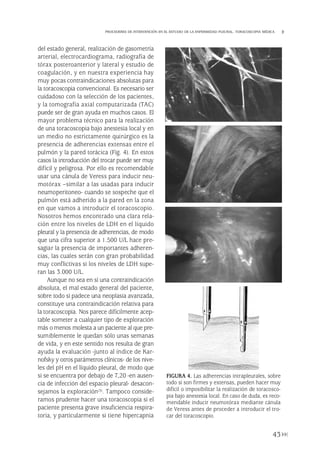 del estado general, realización de gasometría
arterial, electrocardiograma, radiografía de
tórax posteroanterior y lateral y estudio de
coagulación, y en nuestra experiencia hay
muy pocas contraindicaciones absolutas para
la toracoscopia convencional. Es necesario ser
cuidadoso con la selección de los pacientes,
y la tomografía axial computarizada (TAC)
puede ser de gran ayuda en muchos casos. El
mayor problema técnico para la realización
de una toracoscopia bajo anestesia local y en
un medio no estrictamente quirúrgico es la
presencia de adherencias extensas entre el
pulmón y la pared torácica (Fig. 4). En estos
casos la introducción del trocar puede ser muy
difícil y peligrosa. Por ello es recomendable
usar una cánula de Veress para inducir neu-
motórax –similar a las usadas para inducir
neumoperitoneo- cuando se sospeche que el
pulmón está adherido a la pared en la zona
en que vamos a introducir el toracoscopio.
Nosotros hemos encontrado una clara rela-
ción entre los niveles de LDH en el líquido
pleural y la presencia de adherencias, de modo
que una cifra superior a 1.500 U/L hace pre-
sagiar la presencia de importantes adheren-
cias, las cuales serán con gran probabilidad
muy conflictivas si los niveles de LDH supe-
ran las 3.000 U/L.
Aunque no sea en sí una contraindicación
absoluta, el mal estado general del paciente,
sobre todo si padece una neoplasia avanzada,
constituye una contraindicación relativa para
la toracoscopia. Nos parece difícilmente acep-
table someter a cualquier tipo de exploración
más o menos molesta a un paciente al que pre-
sumiblemente le quedan sólo unas semanas
de vida, y en este sentido nos resulta de gran
ayuda la evaluación -junto al índice de Kar-
nofsky y otros parámetros clínicos- de los nive-
les del pH en el líquido pleural, de modo que
si se encuentra por debajo de 7,20 -en ausen-
cia de infección del espacio pleural- desacon-
sejamos la exploración(3). Tampoco conside-
ramos prudente hacer una toracoscopia si el
paciente presenta grave insuficiencia respira-
toria, y particularmente si tiene hipercapnia
43
PROCEDERES DE INTERVENCIÓN EN EL ESTUDIO DE LA ENFERMEDAD PLEURAL. TORACOSCOPIA MÉDICA
FIGURA 4. Las adherencias intrapleurales, sobre
todo si son firmes y extensas, pueden hacer muy
difícil o imposibilitar la realización de toracosco-
pia bajo anestesia local. En caso de duda, es reco-
mendable inducir neumotórax mediante cánula
de Veress antes de proceder a introducir el tro-
car del toracoscopio.
Pleura 224p 9/7/13 10:22 Página 43
 
