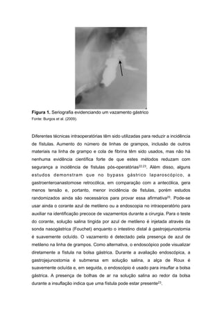 Figura 1. Seriografia evidenciando um vazamento gástrico
Fonte: Burgos et al. (2009).
Diferentes técnicas intraoperatórias têm sido utilizadas para reduzir a incidência
de fístulas. Aumento do número de linhas de grampos, inclusão de outros
materiais na linha de grampo e cola de fibrina têm sido usados, mas não há
nenhuma evidência científica forte de que estes métodos reduzam com
segurança a incidência de fístulas pós-operatórias22,23. Além disso, alguns
estudos demonstram que no bypass gástrico laparoscópico, a
gastroenteroanastomose retrocólica, em comparação com a antecólica, gera
menos tensão e, portanto, menor incidência de fistulas, porém estudos
randomizados ainda são necessários para provar essa afirmativa25. Pode-se
usar ainda o corante azul de metileno ou a endoscopia no intraoperatório para
auxiliar na identificação precoce de vazamentos durante a cirurgia. Para o teste
do corante, solução salina tingida por azul de metileno é injetada através da
sonda nasogástrica (Fouchet) enquanto o intestino distal à gastrojejunostomia
é suavemente ocluído. O vazamento é detectado pela presença de azul de
metileno na linha de grampos. Como alternativa, o endoscópico pode visualizar
diretamente a fístula na bolsa gástrica. Durante a avaliação endoscópica, a
gastrojejunostomia é submersa em solução salina, a alça de Roux é
suavemente ocluída e, em seguida, o endoscópio é usado para insuflar a bolsa
gástrica. A presença de bolhas de ar na solução salina ao redor da bolsa
durante a insuflação indica que uma fístula pode estar presente23.
 