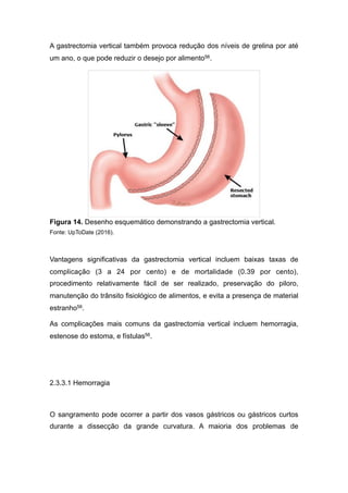 A gastrectomia vertical também provoca redução dos níveis de grelina por até
um ano, o que pode reduzir o desejo por alimento56.
Figura 14. Desenho esquemático demonstrando a gastrectomia vertical.
Fonte: UpToDate (2016).
Vantagens significativas da gastrectomia vertical incluem baixas taxas de
complicação (3 a 24 por cento) e de mortalidade (0.39 por cento),
procedimento relativamente fácil de ser realizado, preservação do piloro,
manutenção do trânsito fisiológico de alimentos, e evita a presença de material
estranho56.
As complicações mais comuns da gastrectomia vertical incluem hemorragia,
estenose do estoma, e fístulas56.
2.3.3.1 Hemorragia
O sangramento pode ocorrer a partir dos vasos gástricos ou gástricos curtos
durante a dissecção da grande curvatura. A maioria dos problemas de
 
