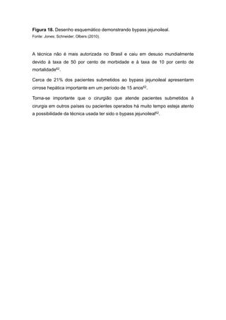 Figura 18. Desenho esquemático demonstrando bypass jejunoileal.
Fonte: Jones; Schneider; Olbers (2010).
A técnica não é mais autorizada no Brasil e caiu em desuso mundialmente
devido à taxa de 50 por cento de morbidade e à taxa de 10 por cento de
mortalidade62.
Cerca de 21% dos pacientes submetidos ao bypass jejunoileal apresentarm
cirrose hepática importante em um período de 15 anos62.
Torna-se importante que o cirurgião que atende pacientes submetidos à
cirurgia em outros países ou pacientes operados há muito tempo esteja atento
a possibilidade da técnica usada ter sido o bypass jejunoileal62.
 