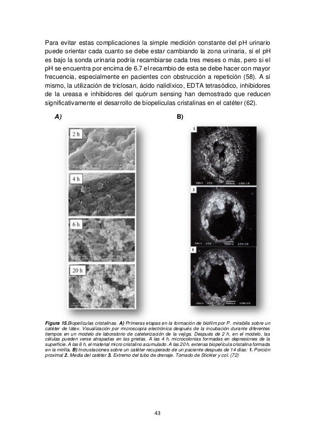 Infección urinaria asociada a catéter vesical Infección urinaria asociada a catéter vesical