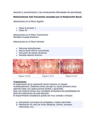 atención y concentración y las consecuentes dificultades de aprendizaje.
Maloclusiones más frecuentes causadas por la Respiración Bucal
Alteraciones en el Plano Sagital:
Clase II división 1
Clase III
Alteraciones en el Plano Transversal:
Mordida Cruzada Posterior:
Alteraciones en el Plano Vertical:
Patrones dolicofaciales
Altura facial inferior aumentada
Extrusión de piezas dentarias
Mordida Abierta Anterior
Tratamiento
El tratamiento de la respiración bucal requiere un equipo
multidisciplinario. Debemos tanto corregir su causa primaria como
además tratar sus repercusiones locales y generales.
Solo una historia clínica muy completa aumentara las posibilidades de
éxito de tratamiento de esta afección.
El requerimiento terapéutico puede ser muy variado e incluye:
a. Extirpación quirúrgica de amígdalas y tejido adenoideo
b. Medicación en caso de rinitis alérgicas, asmas, procesos
infecciosos, etc…
 