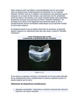debe reeducar este mal hábito, recomendándoles que en las noches
usen un aparato que confeccionamos los dentistas, en un material
llamado "acrílico" que es un plástico. Les pedimos a los pacientes que lo
coloquen en su boca en las noches y que duerman con él, ubicándolo
entre los labios y los dientes y así vayan transformando esta costumbre.
El aparato corrector que ponemos se llama "Pantalla Vestibular". Al
principio se le hacen unos agujeritos que permitan pasar el aire y
paulatinamente iremos cerrándolos hasta llegar que el paciente emplee
su nariz para respirar.
En Posteriormente a que el médico deje libre la vía aérea, el paciente
deberá reeducar su respiración para que sea nasal y usará la "Pantalla
Vestibular".
PLACA VESTIBULAR QUE AYUDA
A REEDUCAR LA RESPIRACIÓN DEL PACIENTE
Figura 1.5.13
Si se coloca un aparato corrector y el paciente no ha sido antes liberado
de su impedimento físico, simplemente no usará su aparato porque no
puede respirar por la nariz.
Utilización de dispositivos ortodóncicos:
Aparatos extraorales: mentonera y tracción extraoral (de inserción
superior) con apoyo occipital.
 