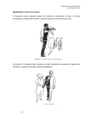 Rehabilitacion EVC ictus