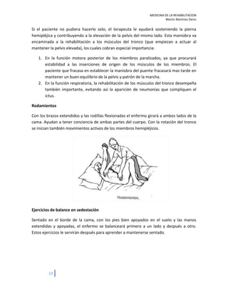 Rehabilitacion EVC ictus