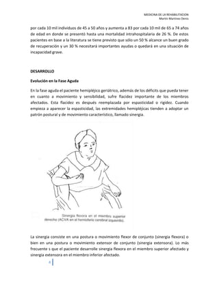 Rehabilitacion EVC ictus