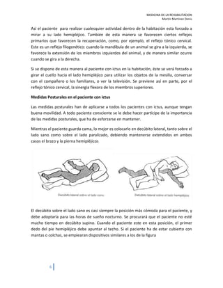 Rehabilitacion EVC ictus