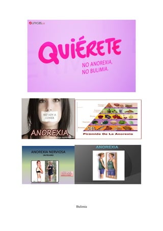 Bulimia
 
