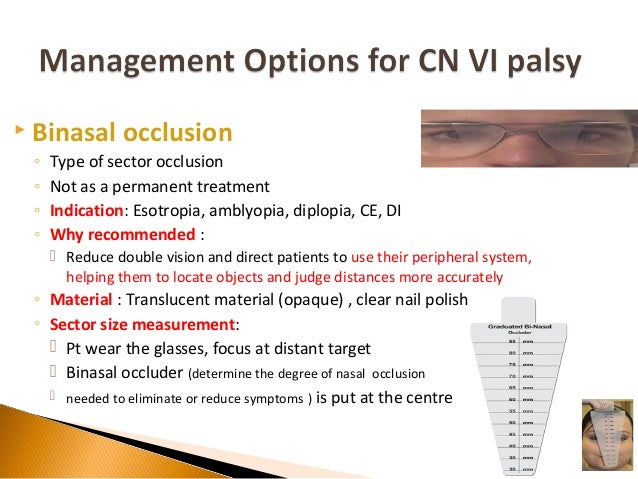Case Study Sixth Nerve Palsy Optometric Management