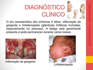 DIAGNÓSTICO
CLÍNICO
DIAGNOSTICANDOAMONONUCLEOSE
O trio característico dos sintomas é febre, inflamação da
garganta e linfadenopatia (glândulas linfáticas inchadas,
especialmente no pescoço). A fadiga está geralmente
presente e pode permanecer durante vários meses.
Inflamação da garganta
Linfadenopatia
 