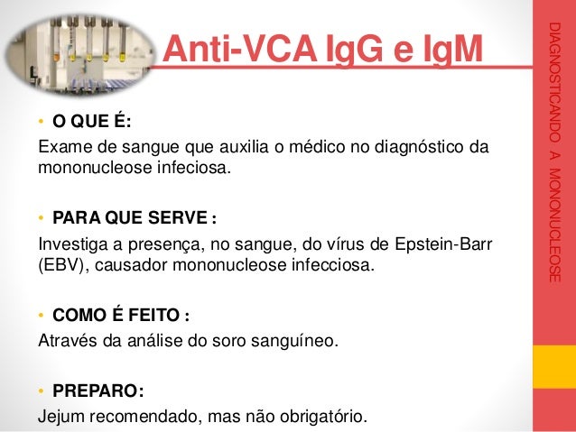 Exame igm