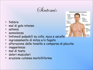 Sintomi:
•   febbre
•   mal di gola intenso
•   astenia
•   sonnolenza
•   linfonodi palpabili su collo, nuca e ascelle
•   ingrossamento di milza e/o fegato
•   alterazione delle tonsille e comparsa di placche
•   inappetenza
•   mal di testa
•   dolori muscolari
•   eruzione cutanea morbilliforme
 