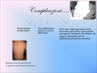 Compilcazioni….

                  Alcune persone                    Una complicazione    Altre rare complicanze sono orchite,
                  restano deboli                    grave è la rottura   miocardite, pericardite, ulcere genitali,
                                                    della milza          neutropenia e polmonite interstiziale. Nei
                                                                         soggetti immunodeficienti la
                                                                         mononucleosi può portare all’exitus




Esantema provocato da somministrazione

                                                .
di ampicillina in corso di mononucleosi infettiva
 