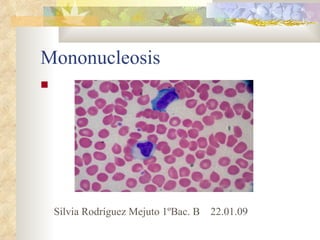 Mononucleosis Silvia Rodríguez Mejuto 1ºBac. B  22.01.09 