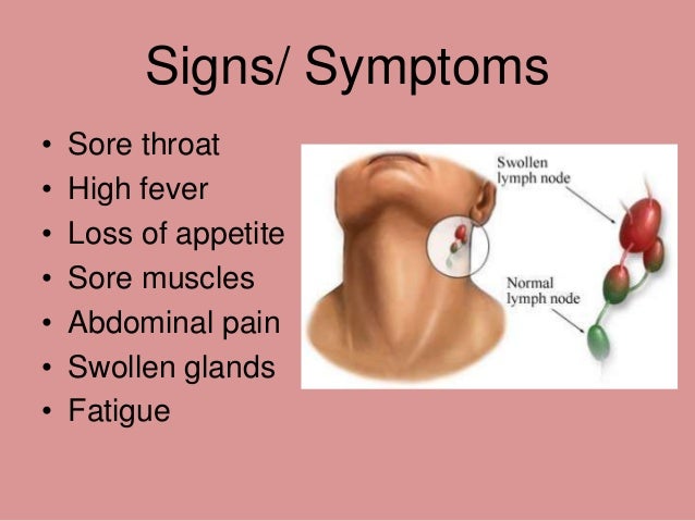 Post Viral Fatigue Natural Treatment Post Viral Fatigue Natural Treatment
