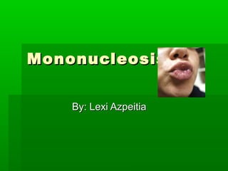Mononucleosis


    By: Lexi Azpeitia
 