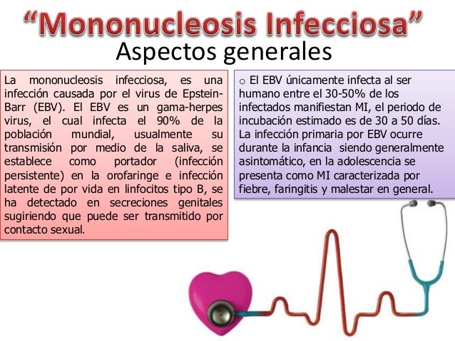 Mononucleosis Infecciosa