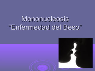 MononucleosisMononucleosis
“Enfermedad del Beso”“Enfermedad del Beso”
 