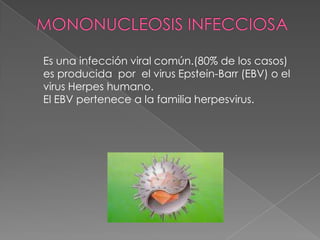 MONONUCLEOSIS INFECCIOSA Es una infección viral común.(80% de los casos) es producida  por  el virus Epstein-Barr (EBV) o el virus Herpes humano.  El EBV pertenece a la familia herpesvirus.  
