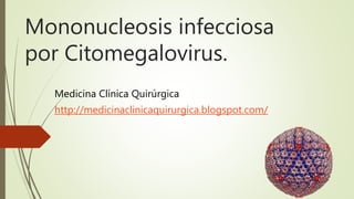 Mononucleosis infecciosa
por Citomegalovirus.
Medicina Clínica Quirúrgica
http://medicinaclinicaquirurgica.blogspot.com/
 