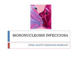 MONONUCLEOSIS INFECCIOSA

      ZINKA MAITE CERNADES SERRUDO
 