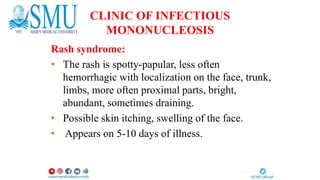 mononucleosis lecture mbbs medicine.ppt. | PPTX