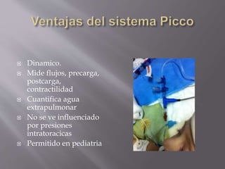  Dinamico.
 Mide flujos, precarga,
postcarga,
contractilidad
 Cuantifica agua
extrapulmonar
 No se ve influenciado
por presiones
intratoracicas
 Permitido en pediatria
 