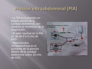 - La PIA es la presión en
estado pasivo de la
cavidad abdominal, con
cambios al momento de la
respiración.
- El valor normal de la PIA
es de de 0 a 5 cms de
H2O.
- Hipertension
intraabdominal es el
aumento de la presión
dentro de la cavidad
abdominal sobre 10 cms
de H2O.
 