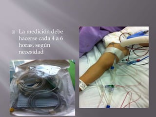  La medición debe
hacerse cada 4 a 6
horas, según
necesidad
 