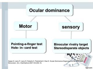 Monovision | PPT