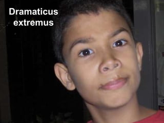 Exatus Sapiens um caso à parte Dramaticus extremus 