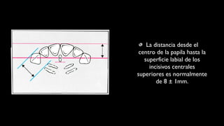 La distancia desde el
centro de la papila hasta la
superficie labial de los
incisivos centrales
superiores es normalmente
de 8 ± 1mm.
 