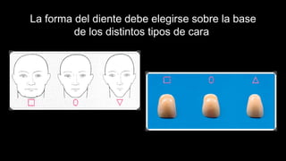 La forma del diente debe elegirse sobre la base
de los distintos tipos de cara
 