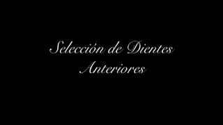 Selección de Dientes
Anteriores
 