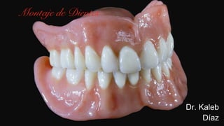 Dr. Kaleb
Díaz
Montaje de Dientes
 