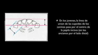 En los jovenes, la linea de
union de las cupsides de los
caninos pasa por el centro de
la papila incisva (en los
ancianos por el lado distal)
 