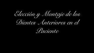 Elección y Montaje de los
Dientes Anteriores en el
Paciente
 