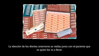 La elección de los dientes anteriores se realiza junto con el paciente que
es quien los va a llevar.
 