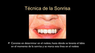 Consiste en determinar en el rodete, hasta dónde se levanta el labio
en el momento de la sonrisa y se marca esta línea en el rodete
Técnica de la Sonrisa
 