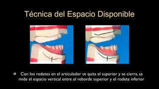 Con los rodetes en el articulador se quita el superior y se cierra, se
mide el espacio vertical entre el reborde superior y el rodete inferior
Técnica del Espacio Disponible
 