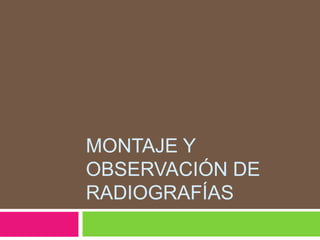 MONTAJE Y
OBSERVACIÓN DE
RADIOGRAFÍAS
 