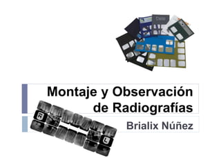 Montaje y Observación
de Radiografías
Brialix Núñez
 