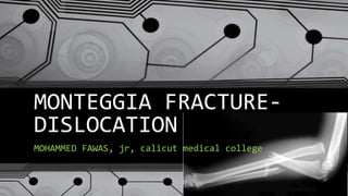 MONTEGGIA FRACTURE-
DISLOCATION
MOHAMMED FAWAS, jr, calicut medical college
 
