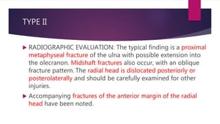 TYPE II
 RADIOGRAPHIC EVALUATION: The typical finding is a proximal
metaphyseal fracture of the ulna with possible extension into
the olecranon. Midshaft fractures also occur, with an oblique
fracture pattern. The radial head is dislocated posteriorly or
posterolaterally and should be carefully examined for other
injuries.
 Accompanying fractures of the anterior margin of the radial
head have been noted.
 
