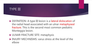 TYPE III
 DEFINITION: A type III lesion is a lateral dislocation of
the radial head associated with an ulnar metaphyseal
fracture. This is the second most common pediatric
Monteggia lesion.
 ULNAR FRACTURE SITE: metaphysis
 INJURY MECHNISMS: varus stress at the level of the
elbow
 