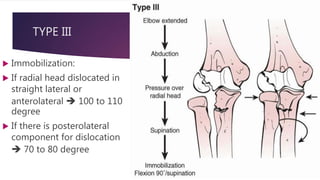 TYPE III
 Immobilization:
 If radial head dislocated in
straight lateral or
anterolateral  100 to 110
degree
 If there is posterolateral
component for dislocation
 70 to 80 degree
 